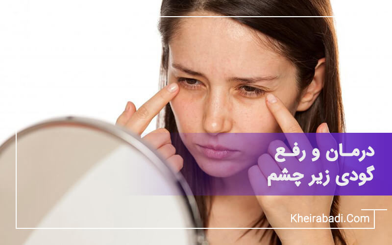 درمان و رفع گودی زیر چشم با تزریق فیلر زیر چشم