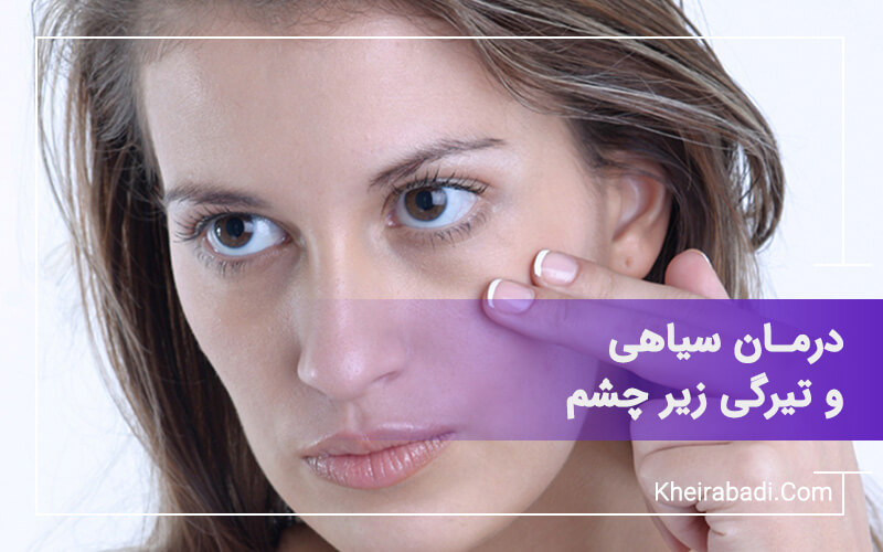 درمان سیاهی زیر چشم با تزریق فیلر زیر چشم